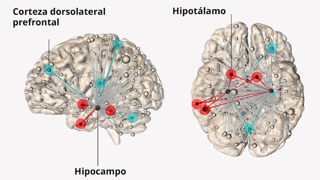 ¿Cómo Afecta El Estrés Al Cerebro?